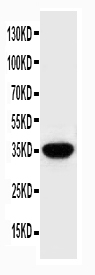 1 - Anti-SPARC Antibody ABO10899