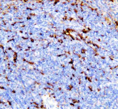 2 - Anti-TREM-1 Antibody ABO10900
