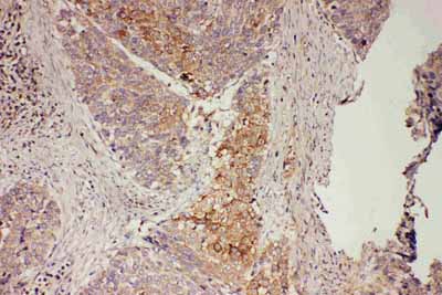 2 - Anti-GRB7 Antibody ABO10903