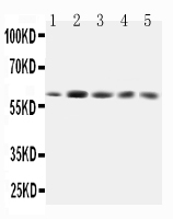 1 - Anti-GRB7 Antibody ABO10903