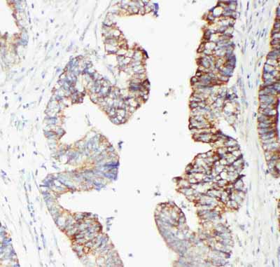 2 - Anti-GST3/GST Pi Antibody ABO10904