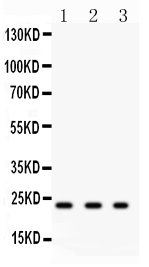 1 - Anti-GST3/GST Pi Antibody ABO10904