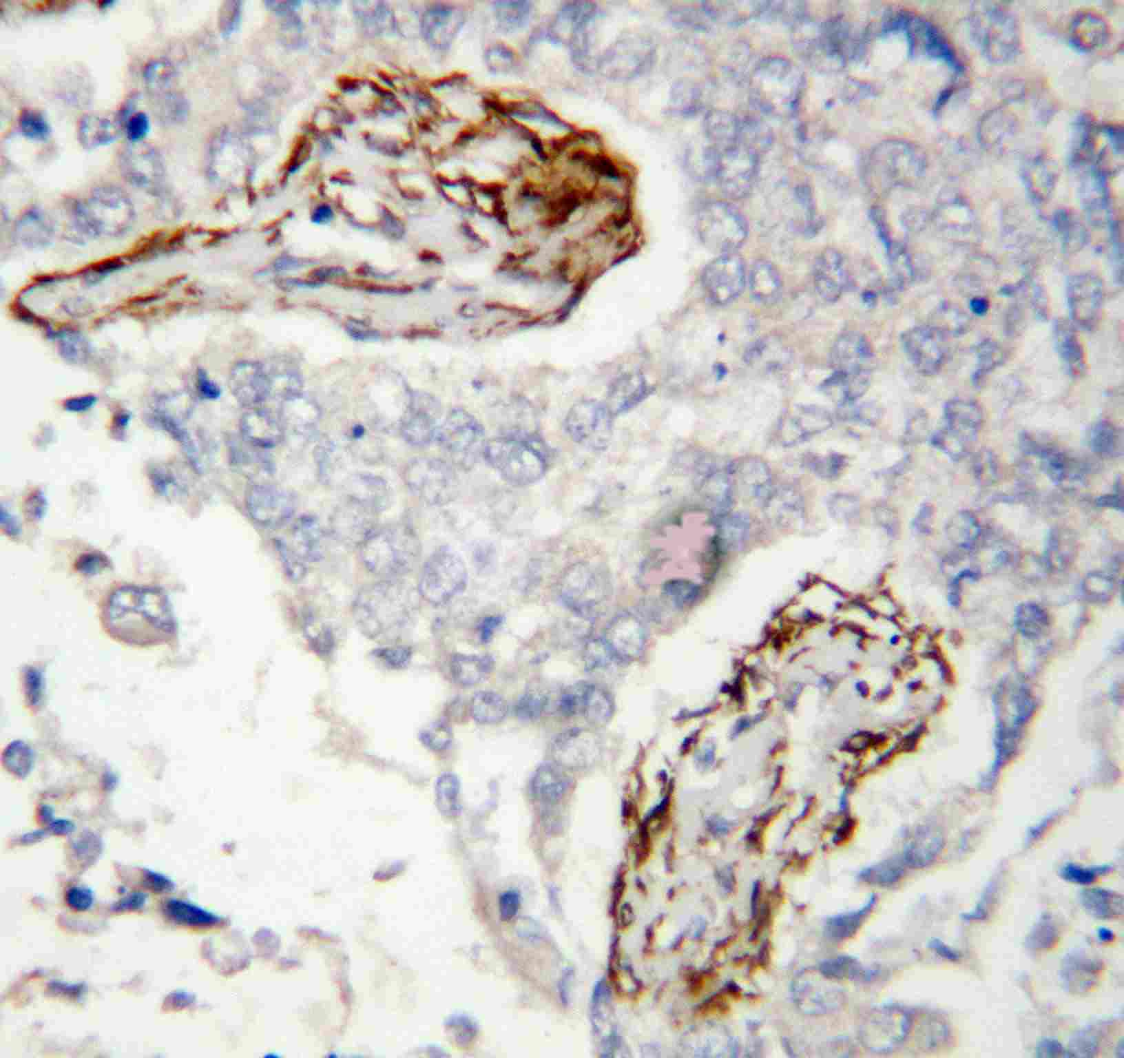 2 - Anti-HDAC8 Antibody ABO10905