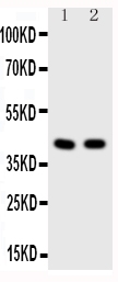 1 - Anti-HDAC8 Antibody ABO10905