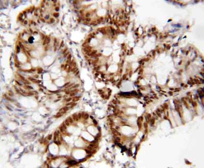 2 - Anti-FOXP1 Antibody ABO10907