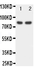 1 - Anti-FOXP1 Antibody ABO10907
