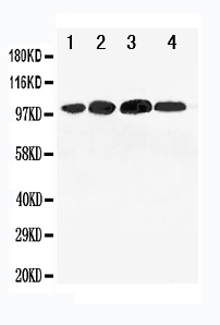 1 - Anti-NR3C2 Antibody ABO10908