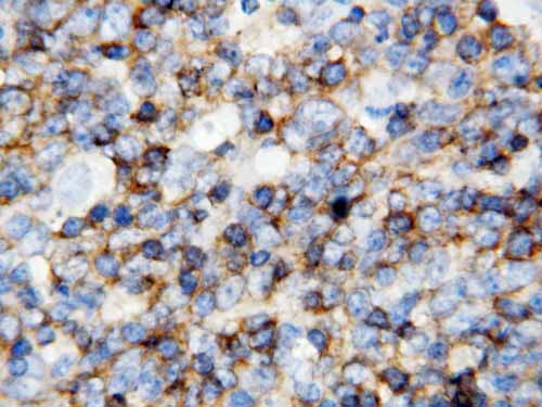 2 - Anti-CD45 Antibody ABO10910