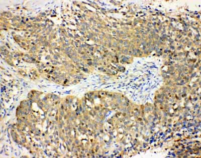2 - Anti-Haptoglobin Antibody ABO10913