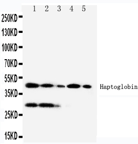 1 - Anti-Haptoglobin Antibody ABO10913