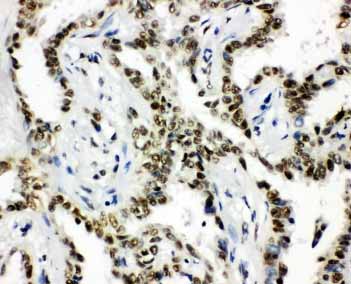 2 - Anti-HDAC3 Antibody ABO10914