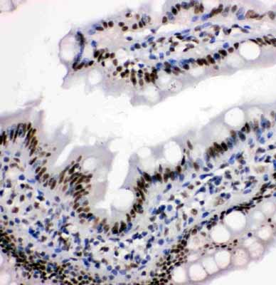 2 - Anti-HDAC3 Antibody ABO10914