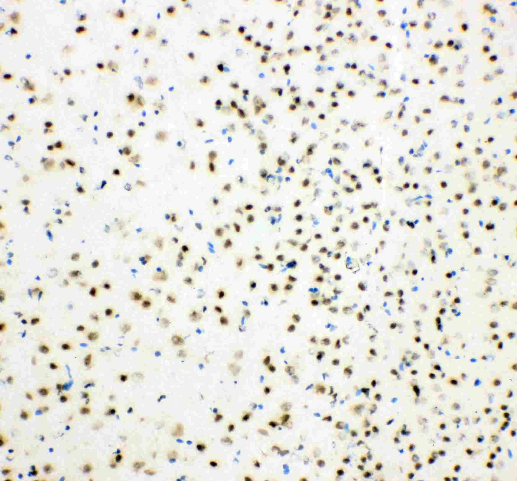 2 - Anti-HDAC3 Antibody ABO10914