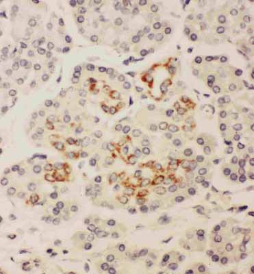 2 - Anti-HOXA3 Antibody ABO10916