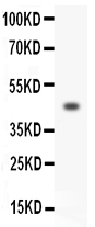 1 - Anti-HOXA3 Antibody ABO10916