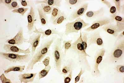 8 - Anti-HOXA4 Antibody ABO10917
