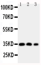 1 - Anti-HOXA4 Antibody ABO10917
