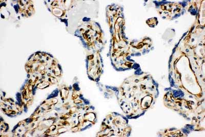 2 - Anti-HSD17B2 Antibody ABO10918