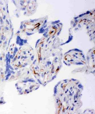 2 - Anti-HSD17B2 Antibody ABO10918