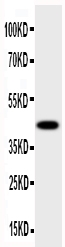 1 - Anti-HSD17B2 Antibody ABO10918