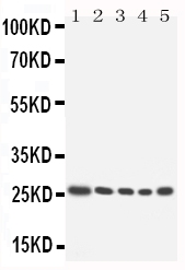 1 - Anti-HOXA6 Antibody ABO10920