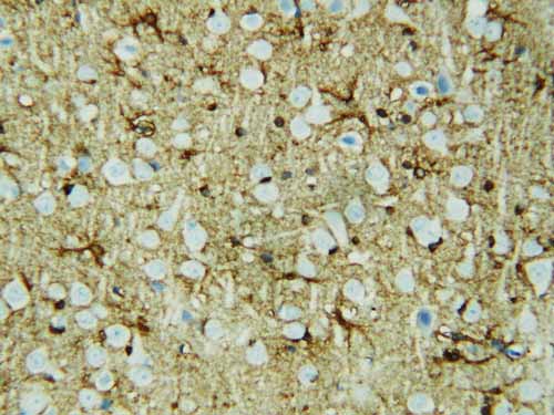 2 - Anti-HSF2 Antibody ABO10922