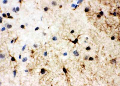 2 - Anti-HSF2 Antibody ABO10922