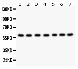 1 - Anti-HSF2 Antibody ABO10922