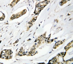 2 - Anti-Hsp105 Antibody ABO10923