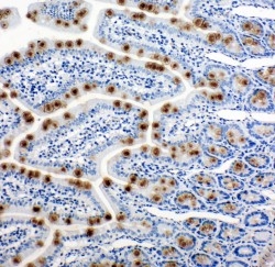 2 - Anti-Hsp105 Antibody ABO10923