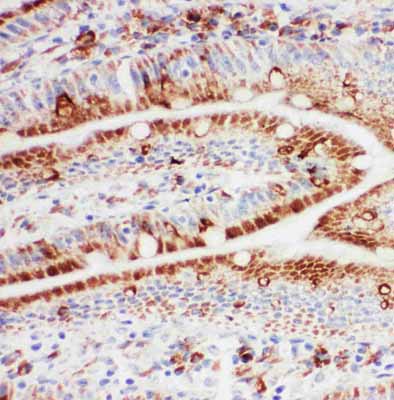2 - Anti-Hsp105 Antibody ABO10923