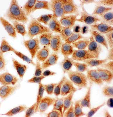8 - Anti-HSD17B1 Antibody ABO10927