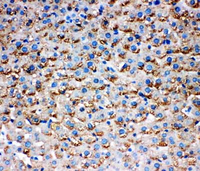 2 - Anti-HSD17B1 Antibody ABO10927