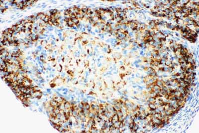 2 - Anti-HSD17B1 Antibody ABO10927