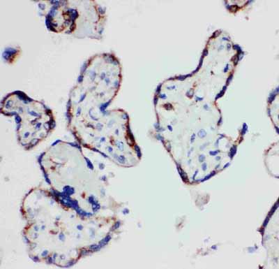 2 - Anti-HSD17B1 Antibody ABO10927