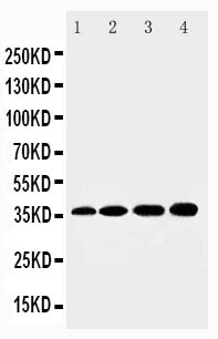 1 - Anti-HSD17B1 Antibody ABO10927