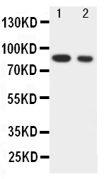 1 - Anti-IKK Alpha Antibody ABO10928