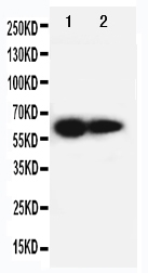 1 - Anti-IL2RB Antibody ABO10929