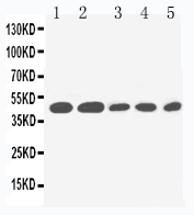 1 - Anti-IL2 Receptor Gamma Antibody ABO10930