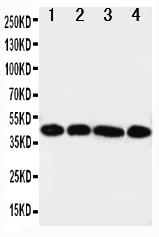 1 - Anti-IL3RA Antibody ABO10931
