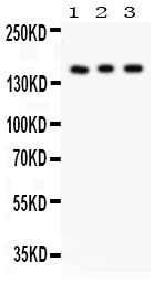 1 - Anti-Insulin Receptor Antibody ABO10933