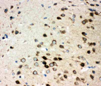 2 - Anti-Integrin Alpha 3 Antibody ABO10934