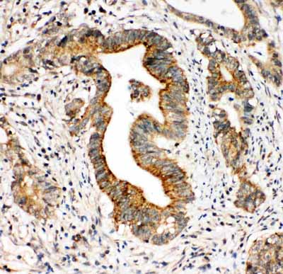 2 - Anti-Integrin Alpha 3 Antibody ABO10934