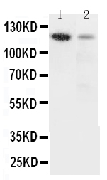 1 - Anti-Integrin Alpha 3 Antibody ABO10934