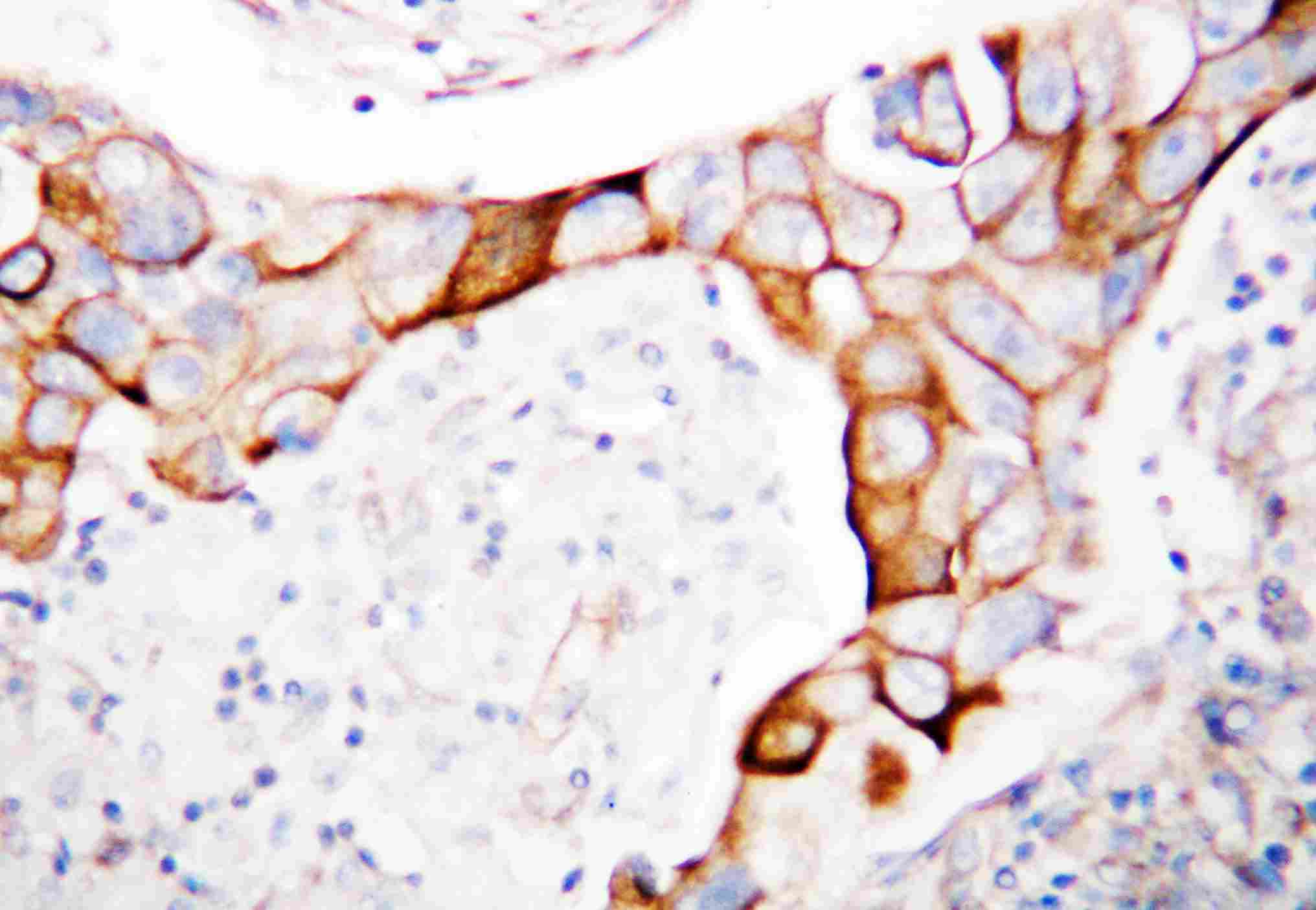 2 - Anti-CD18 Antibody ABO10937