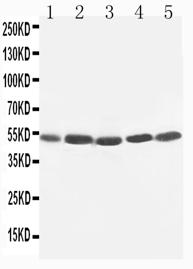 1 - Anti-KIM1 Antibody ABO10938