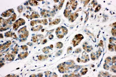 2 - Anti-KLK1 Antibody ABO10939