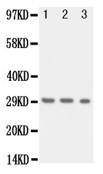 1 - Anti-KLK1 Antibody ABO10939
