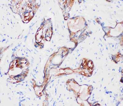 2 - Anti-Kallikrein 2 Antibody ABO10940