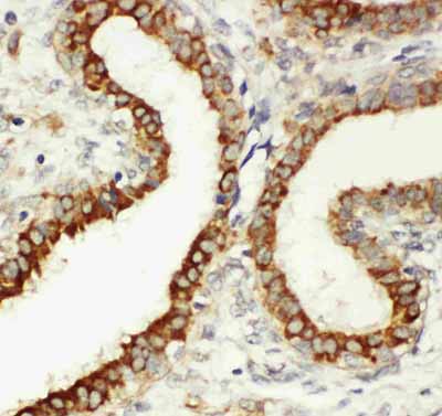2 - Anti-Integrin Beta 3 Antibody ABO10941